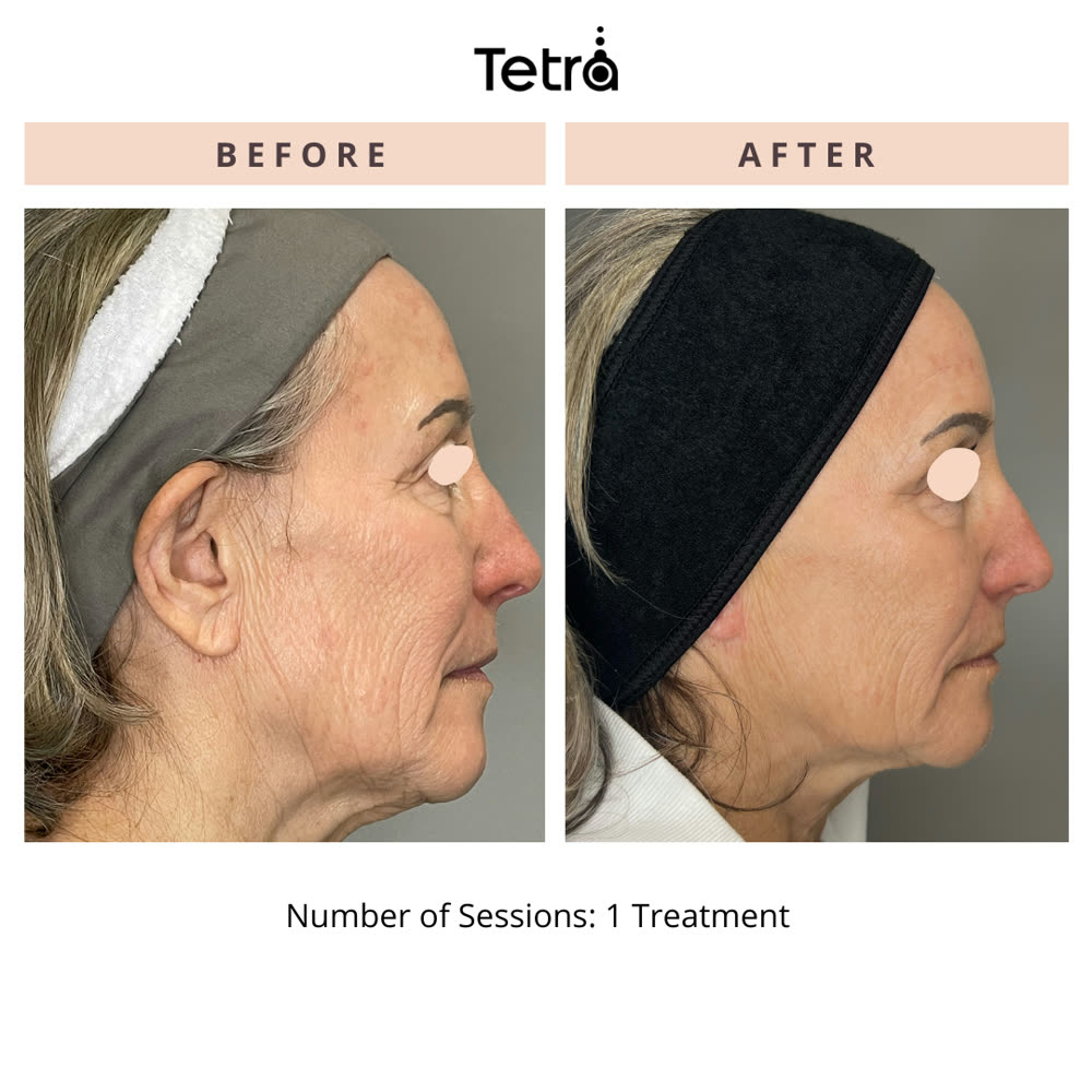 Tetra CO2 before and after