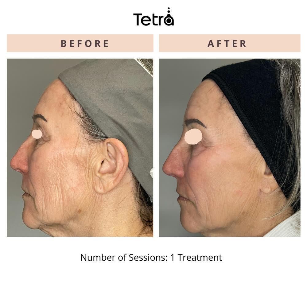 Tetra CO2 before and after