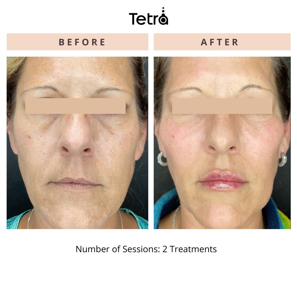 Tetra CO2 before and after