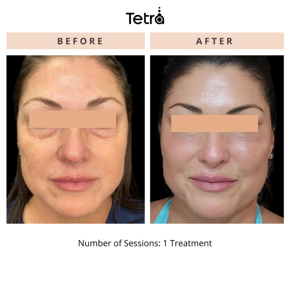 Tetra CO2 before and after