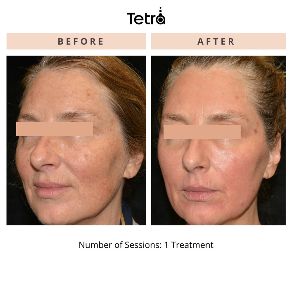 Tetra CO2 before and after