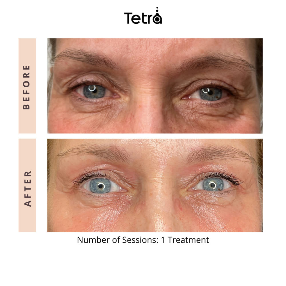 Tetra CO2 before and after