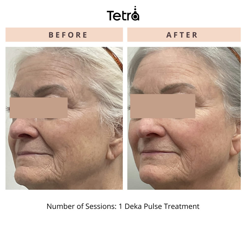 Tetra CO2 before and after
