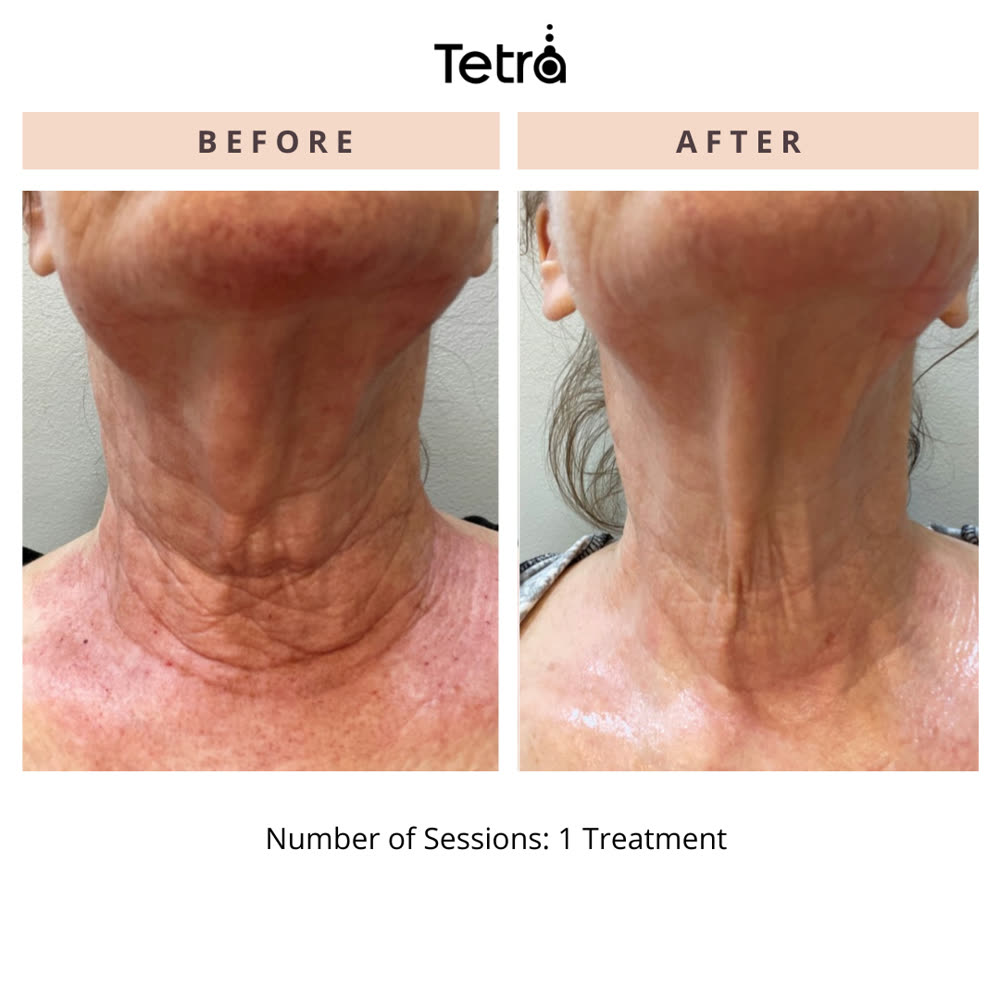 Tetra CO2 before and after