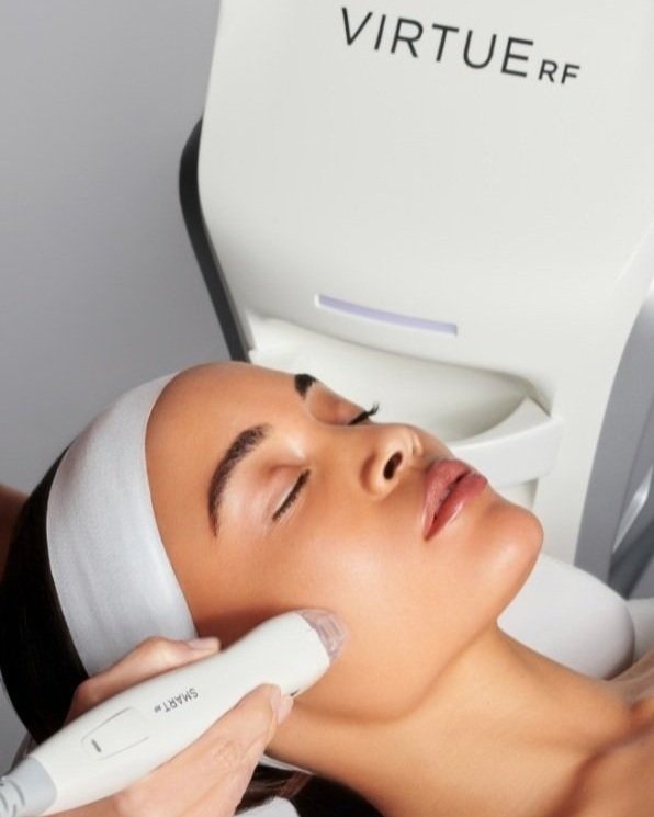 VirtueRF Microneedling: A Revolutionary Treatment for Skin Rejuvenation