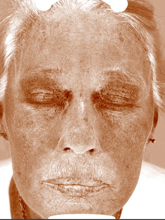 Pamela in the Visia Brown Spots view three years later