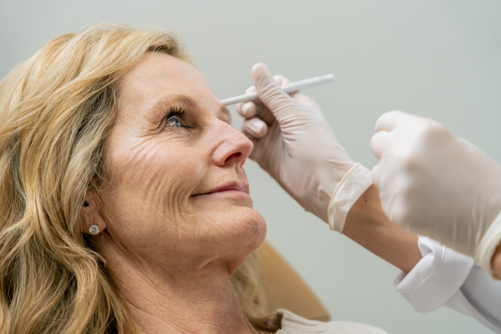 Injector mapping Botox injection points on a guest's brow at Carroll Cosmetic Club